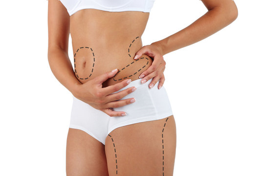 Lipoescultura de alta definição